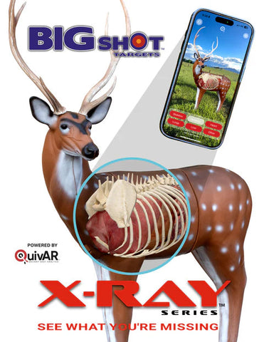 X-Ray Series